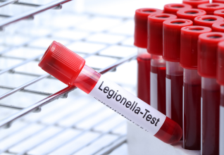 Basic_Legionella_Management.png