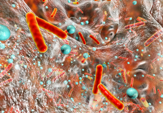 Legionella Awareness