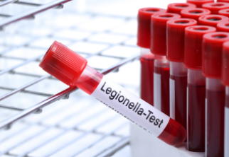 Basic_Legionella_Management.png